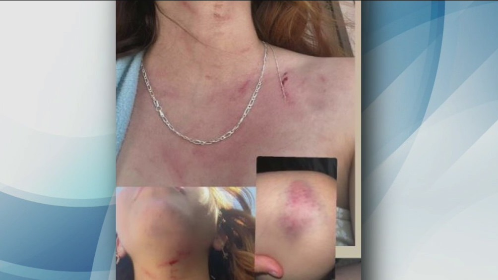 Girl assaulted in Long Beach
