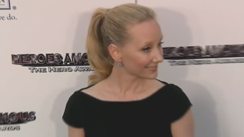 Anne Heche dead at 53