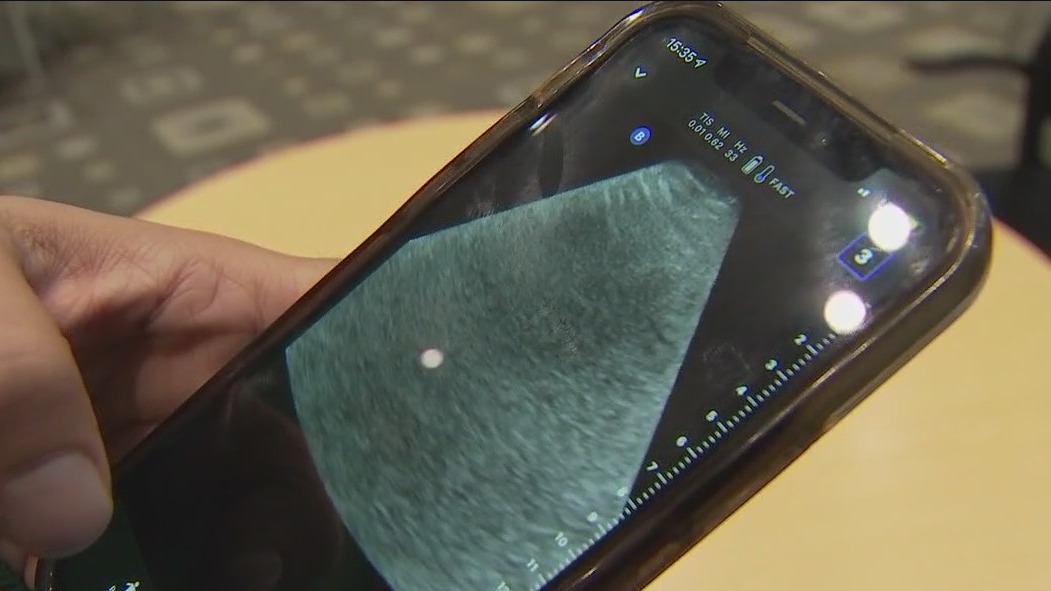 ATCEMS adding new ultrasound tech to ambulances acros Austin