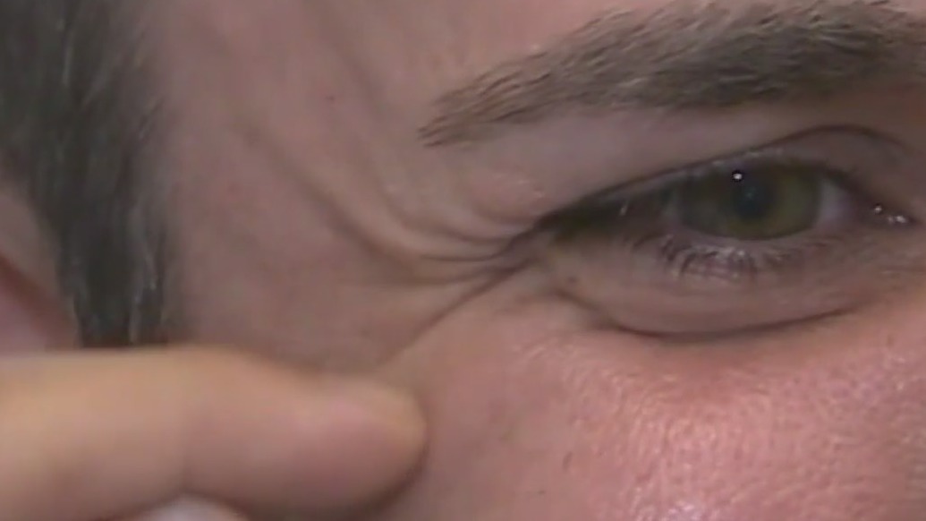 New book delves into the transformative history of Botox