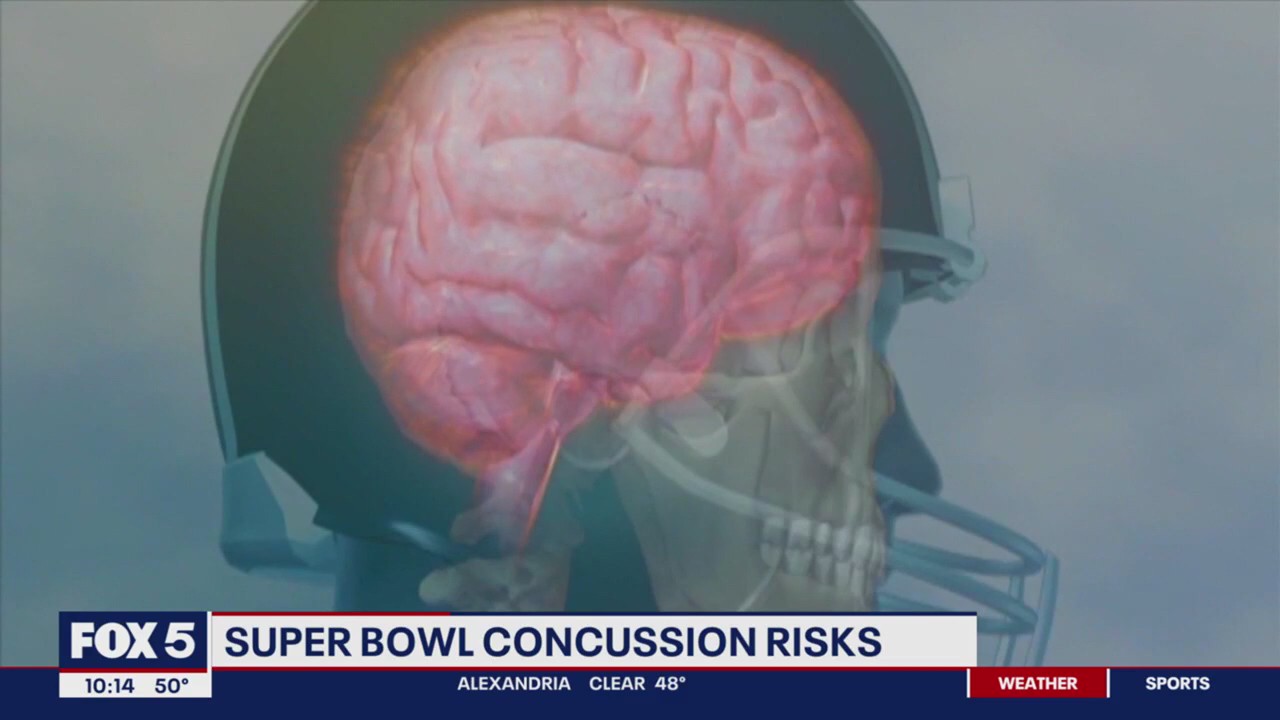Super Bowl concussion risks