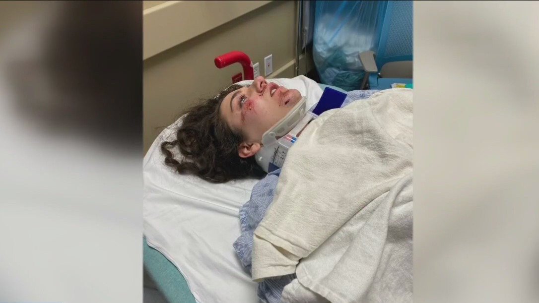 Woman hit by car while riding scooter in Austin; APD not investigating incident as hit-and-run
