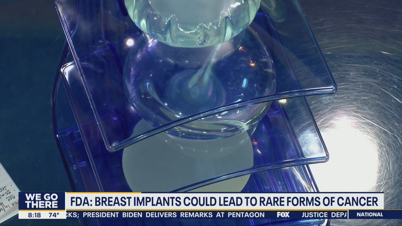 Breast implants could lead to rare forms of cancer, FDA says