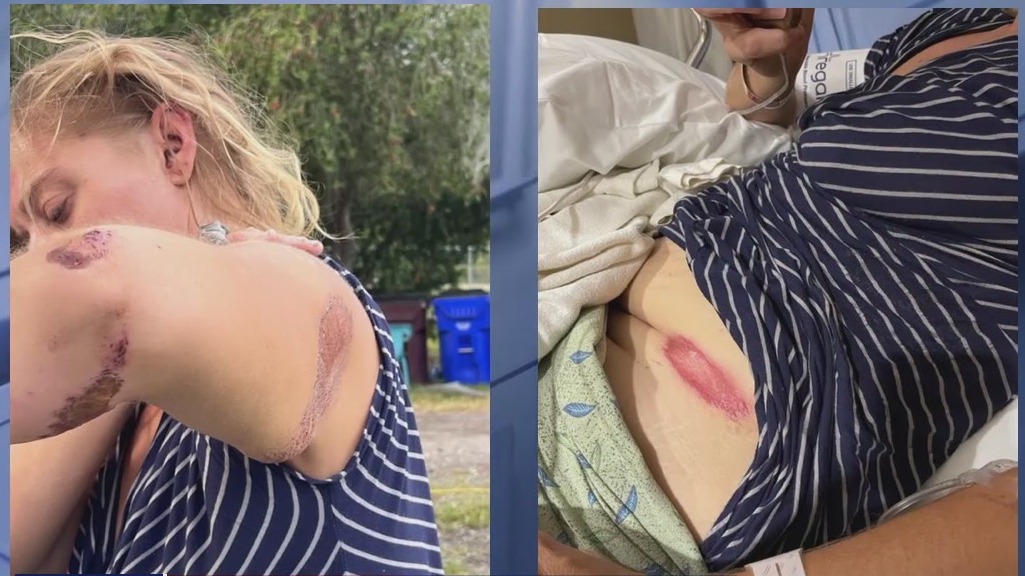 HIT AND RUN: Search for hit and run driver after violent crash towards bike-rider woman in Kissimmee