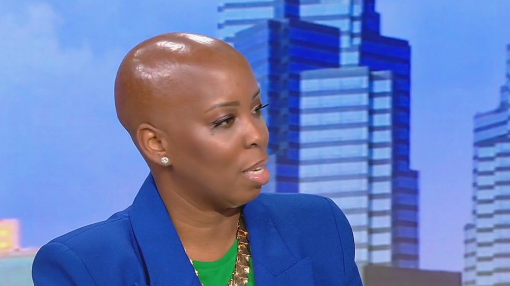 Convention reduces stigma around hair loss