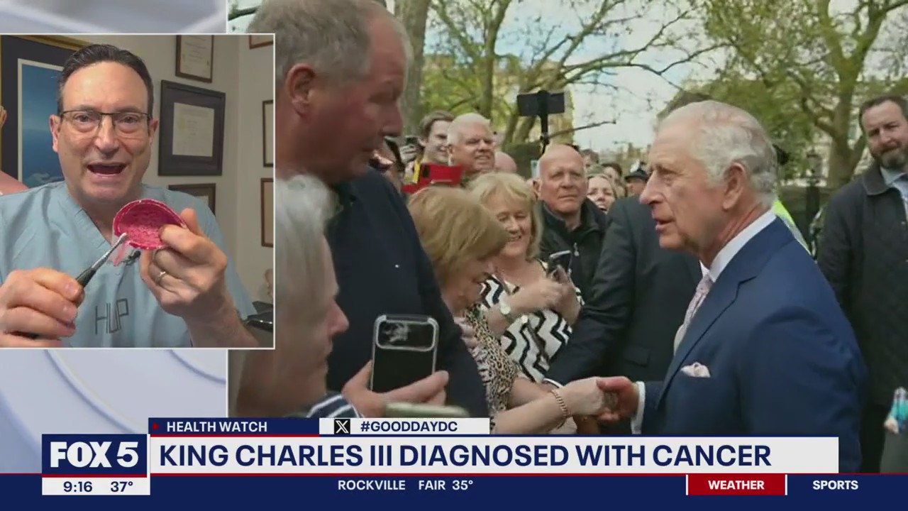 Dr. Mike weighs in on King Charles III cancer diagnosis
