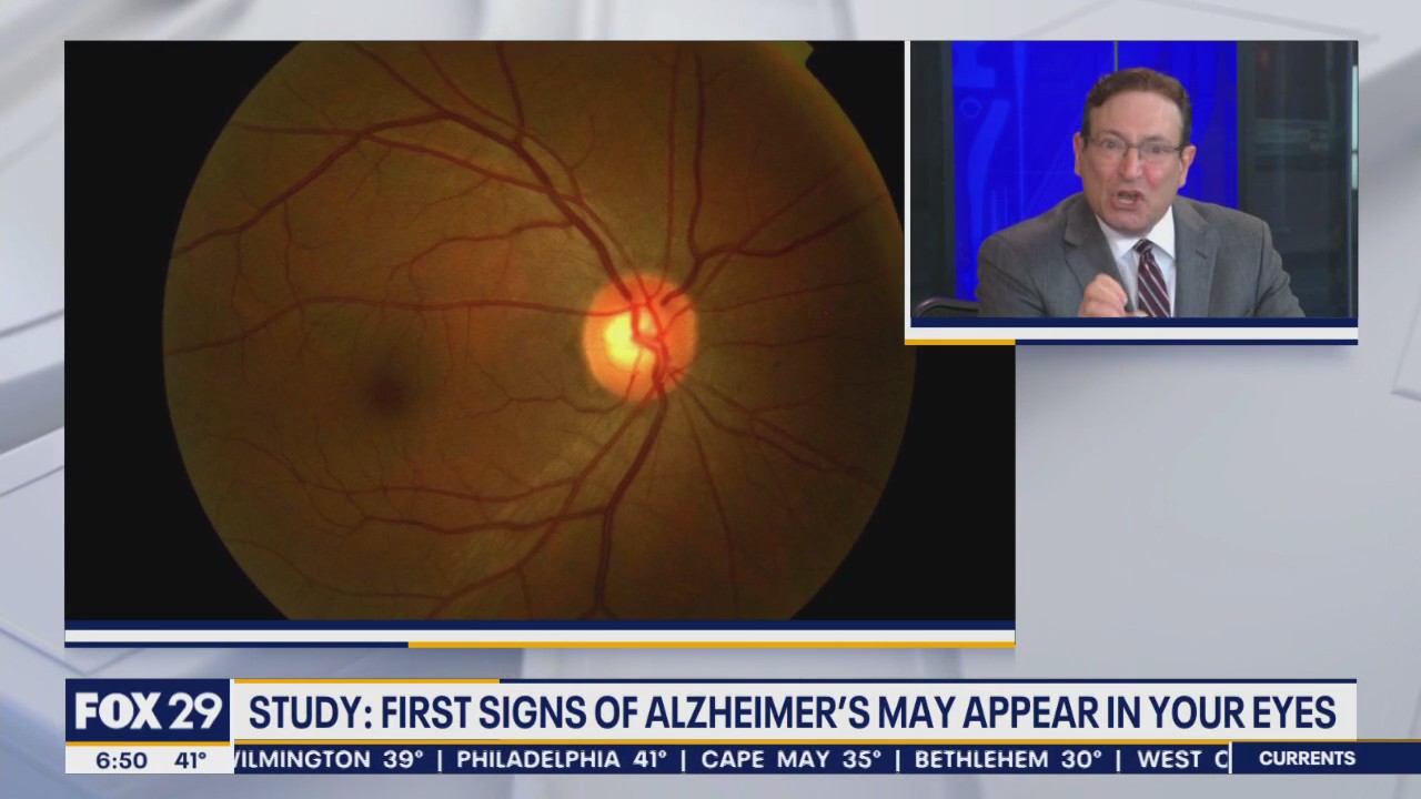 Health Watch: 'Smart' bandages; first signs of Alzheimer's