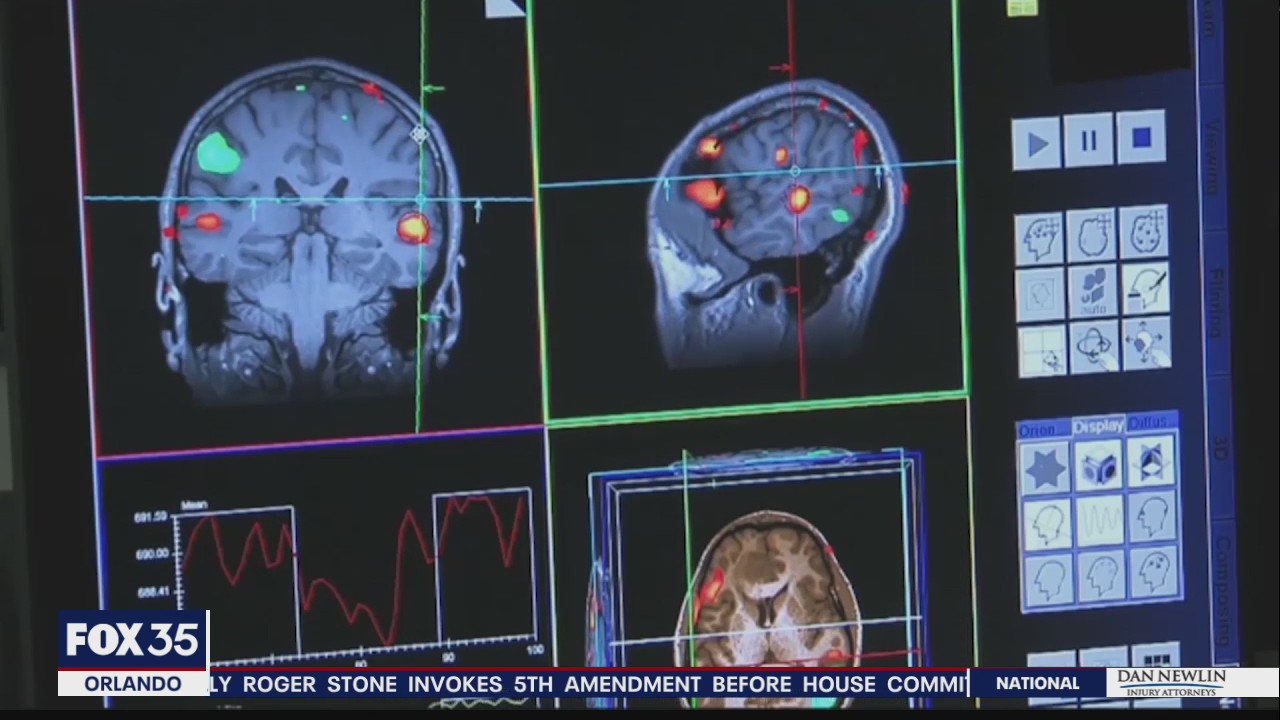 Artificial intelligence could be key for early detection of Alzheimer's