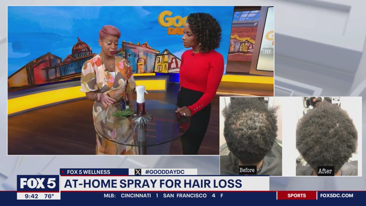At-home spray for hair loss