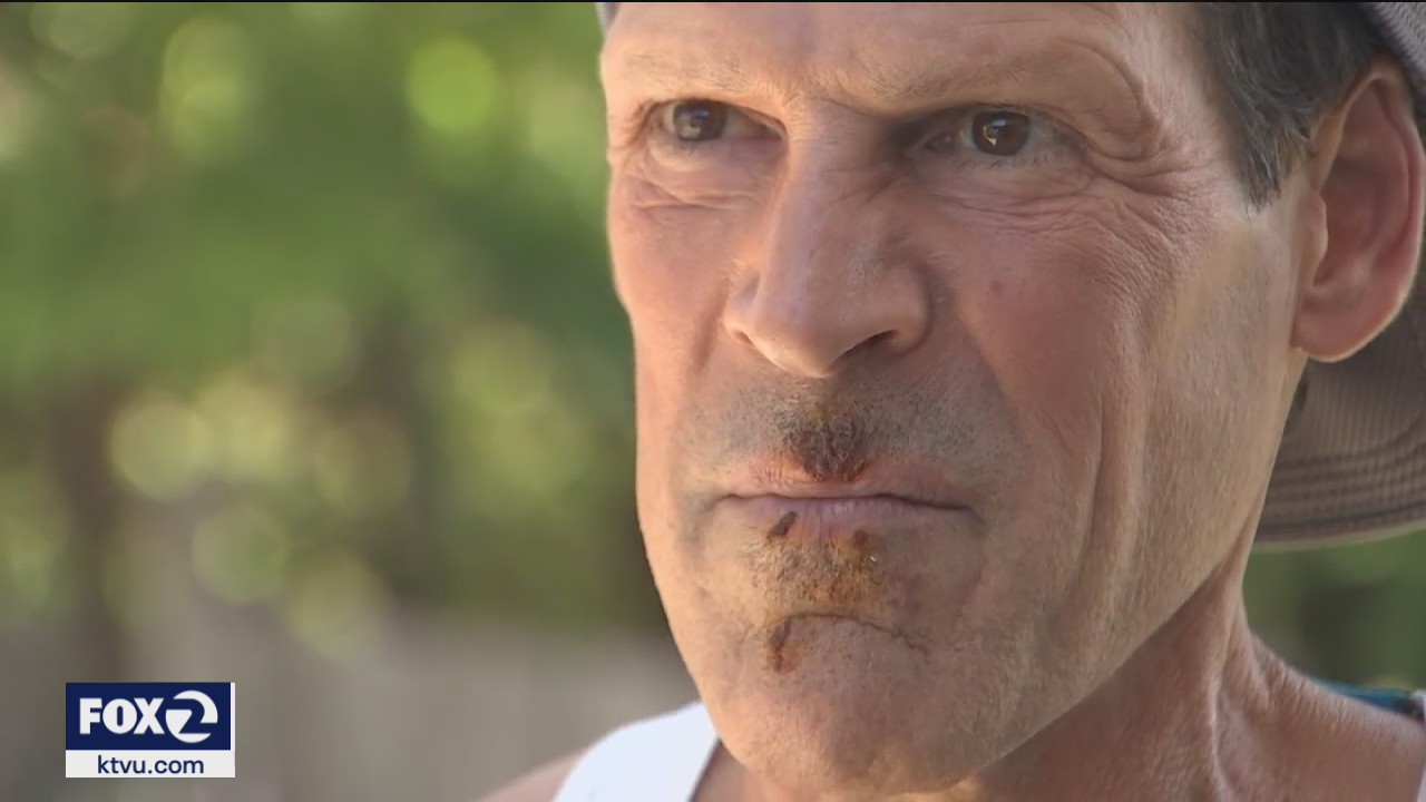 Ultramarathon runner Dean Karnazes recounts frightening encounter with coyote near Golden Gate Bridge