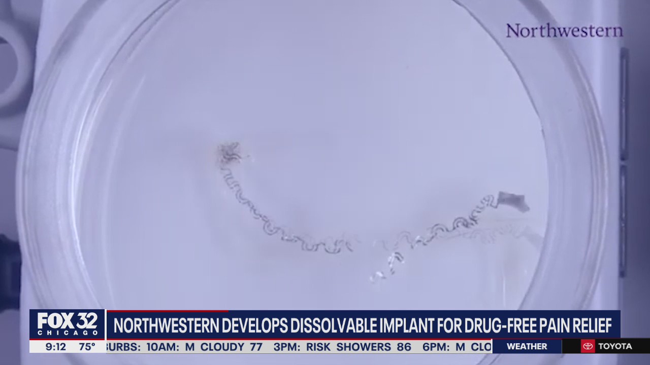 Northwestern researchers develop dissolvable implant for drug-free pain relief post-surgery