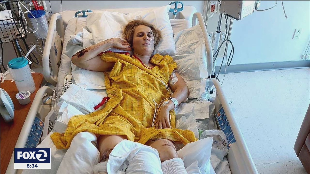 Rock climber from New Zealand slapped with $600K hospital bill after Yosemite fall
