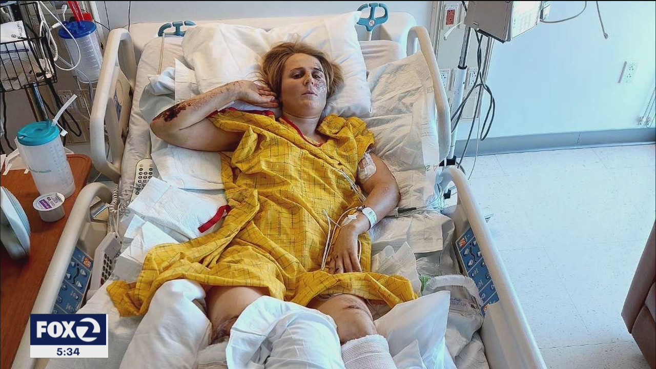 Rock Climber From New Zealand Slapped With 600k Hospital Bill After