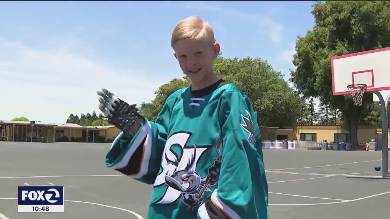 9-year-old boy gets prosthetic hand thanks to 8th grade tech class