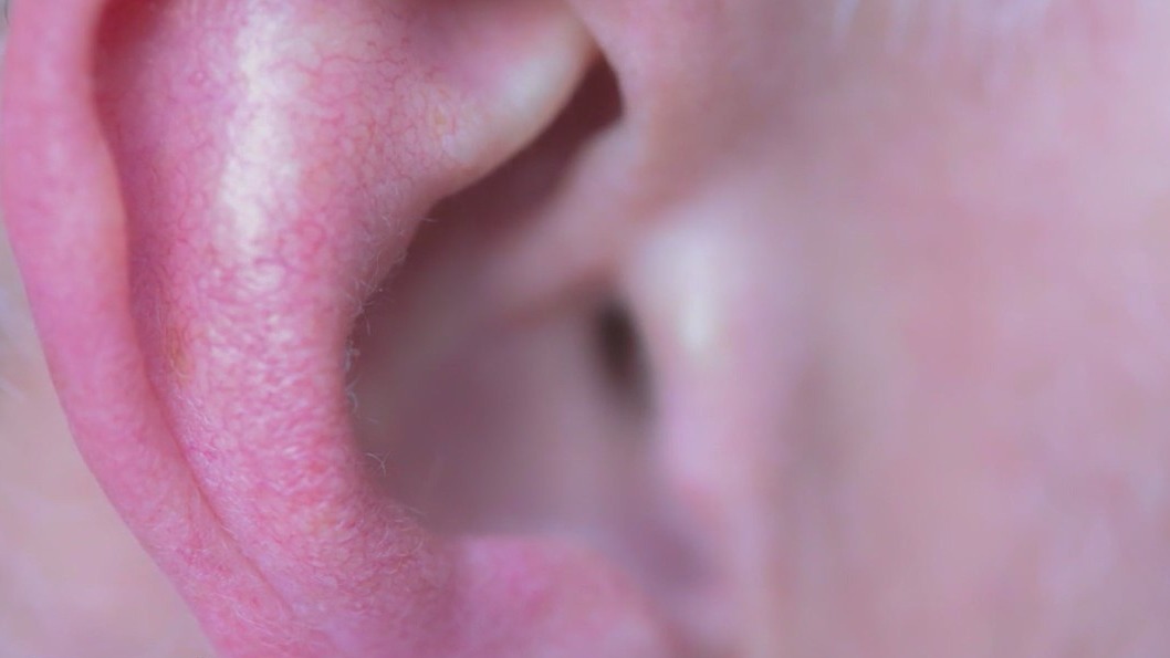 What is tinnitus, can it be cured?
