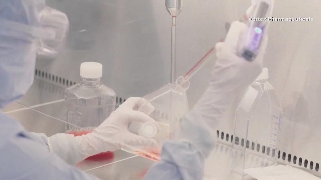 Gene treatment for sickle cell now at Dallas hospital