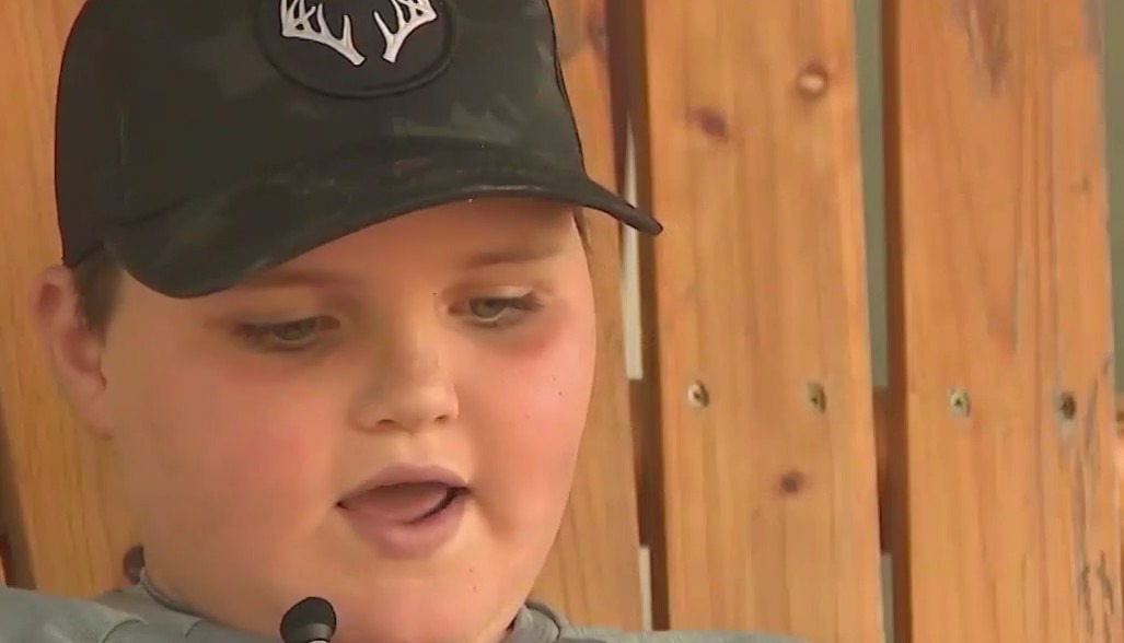 Banks County boy talks about being bit by bobcat