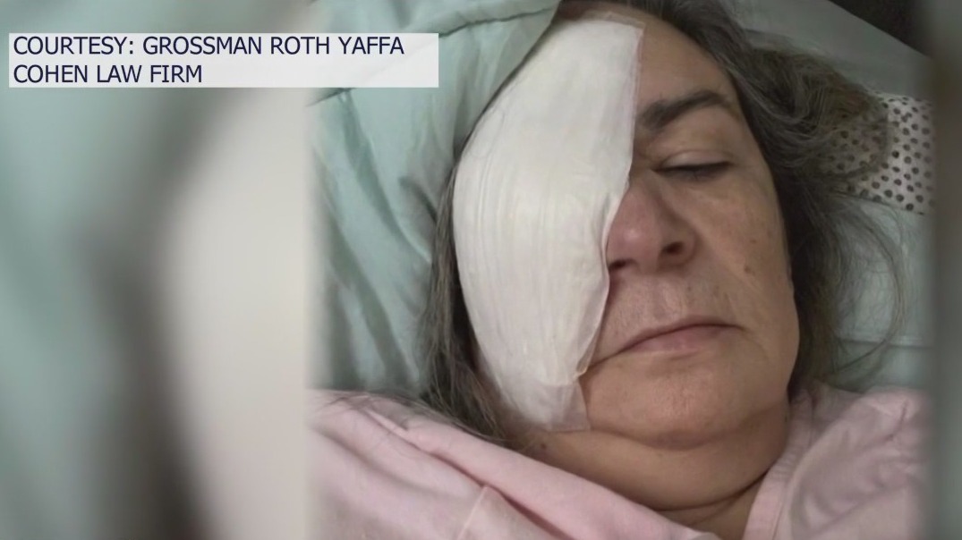 Woman loses eye after using contaminated eye drops