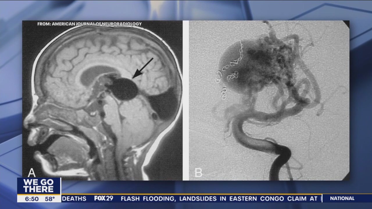 Doctors perform brain surgery on fetus in mother's womb
