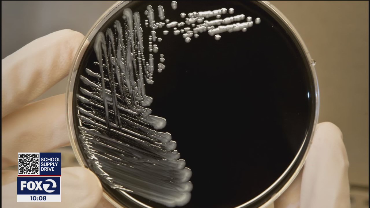 Outbreak of Legionnaires' disease in Napa County causes one death