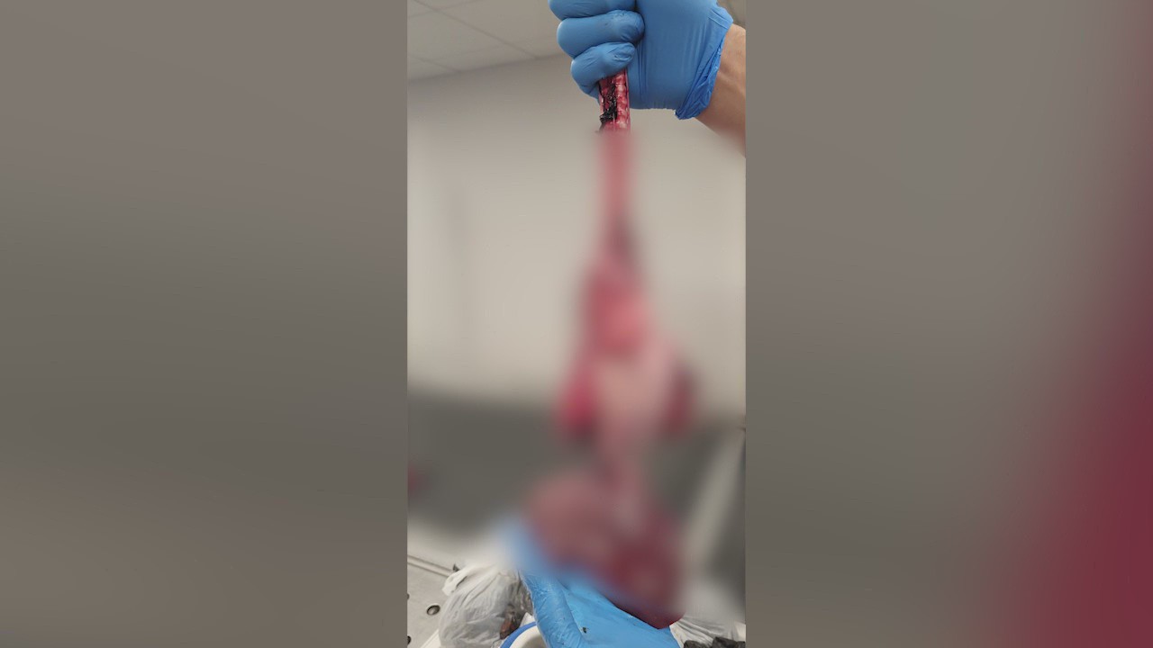 Customs and Border Protection makes bizarre discovery at Chicago airport