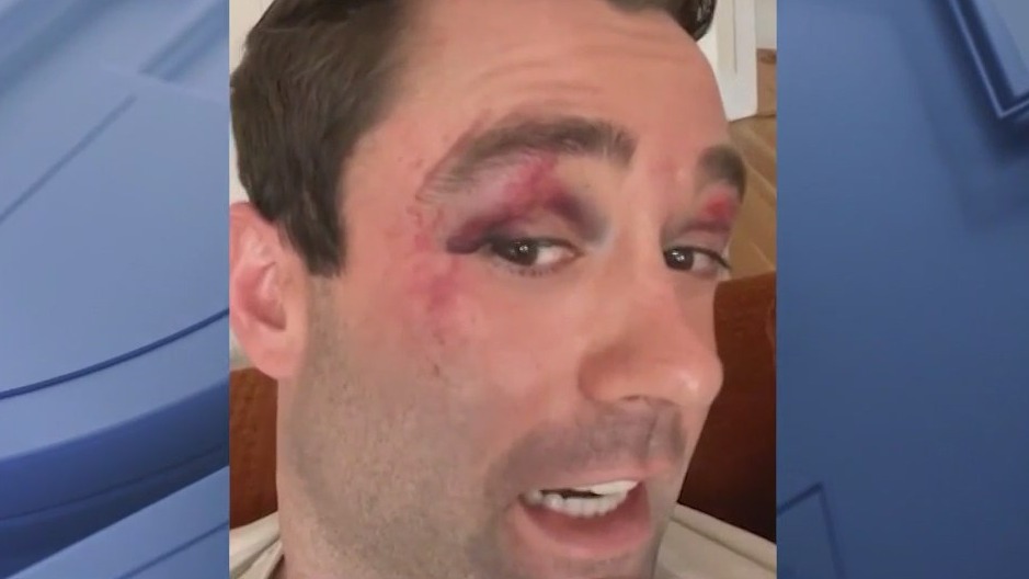 Meteorologist says he was attacked on NYC subway