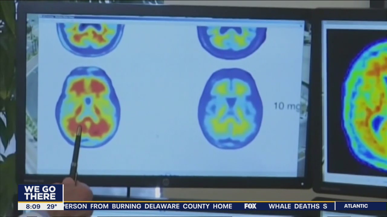 New hope for people living with Alzheimer’s