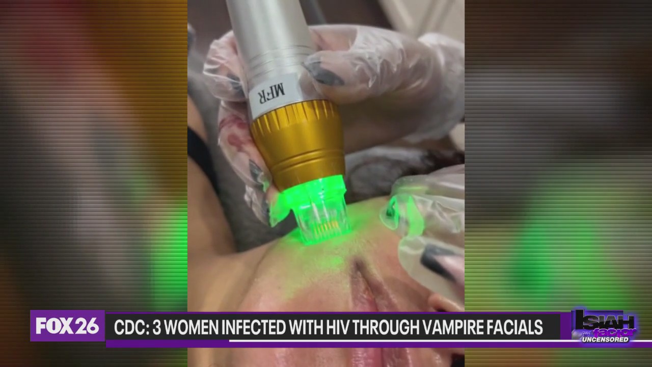 CDC: 3 women infected with HIV through vampire facials
