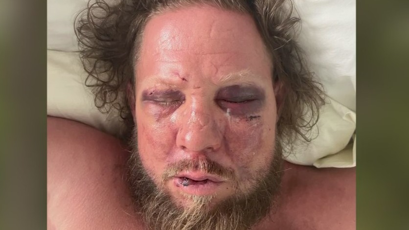Florida father, son stomped on victim 'until he’s unconscious' at wedding reception, sheriff says