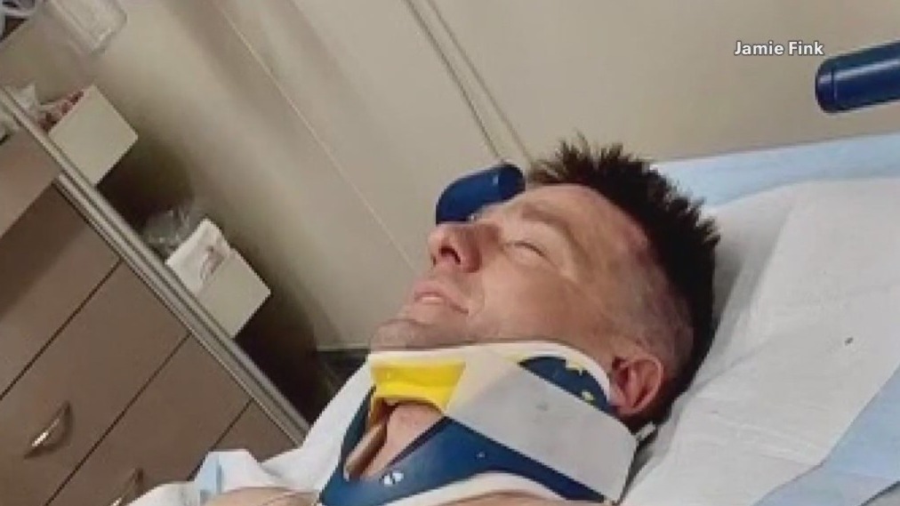 Milwaukee firefighter fell from roof, badly hurt; daughter's kidney failing