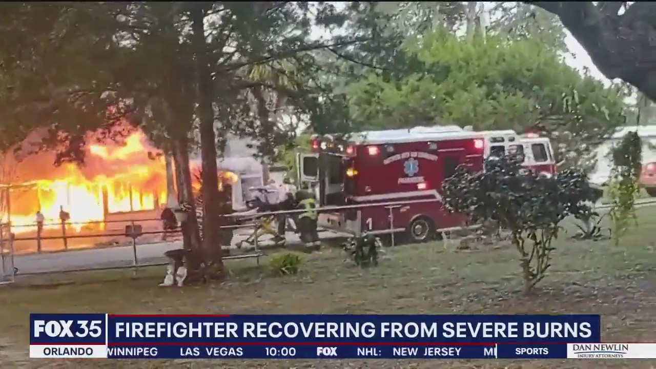 Florida firefighter badly burned in house fire
