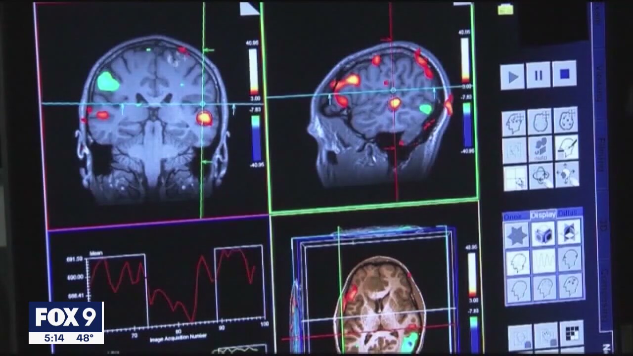 Racial disparities in diagnosing Alzheimer's disease