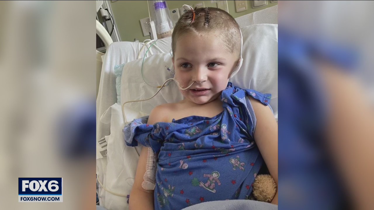 Motorcycle ride benefits boy injured in lawnmower accident