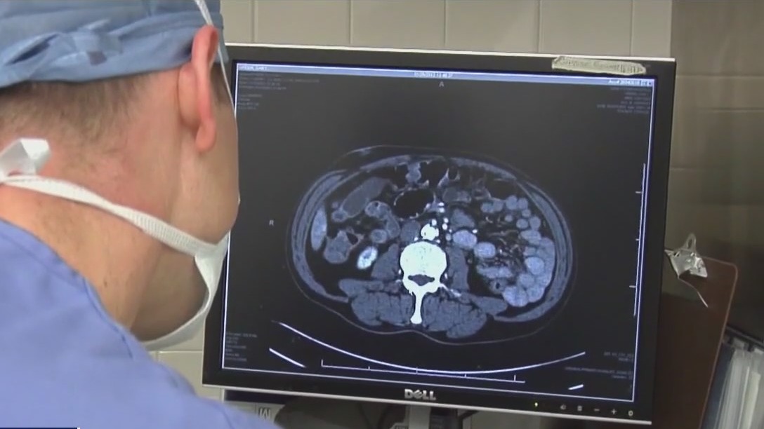 Debate over renaming lowest-risk prostate cancer