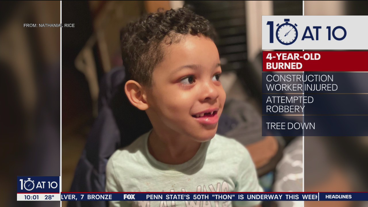 4-year-old boy badly burned in West Philadelphia fire