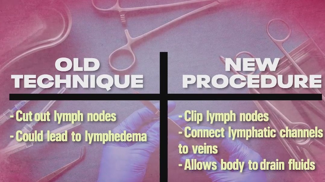 Breast Cancer Awareness: Preventing painful side effects of lymph node removal