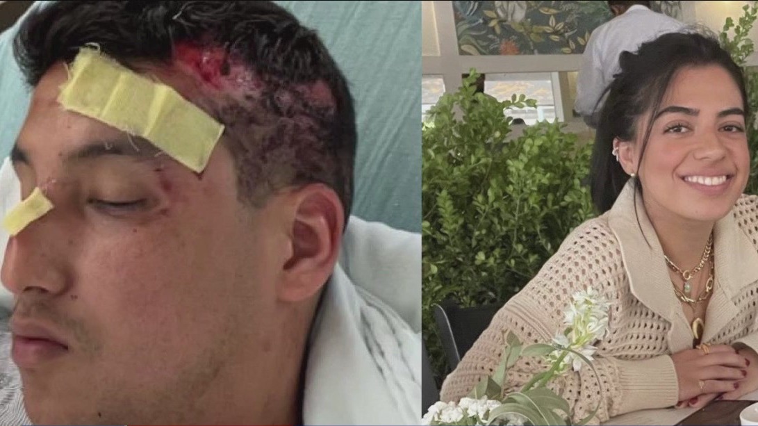Street racer hits, seriously injures two people