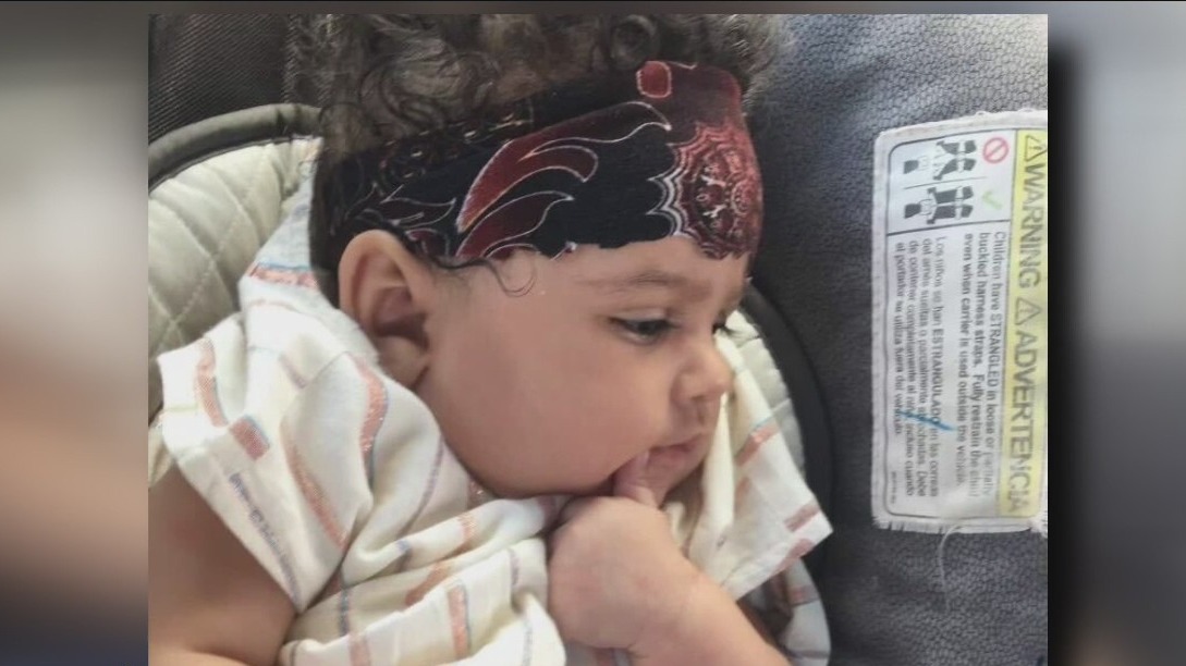 Toddler accidentally shot by brother