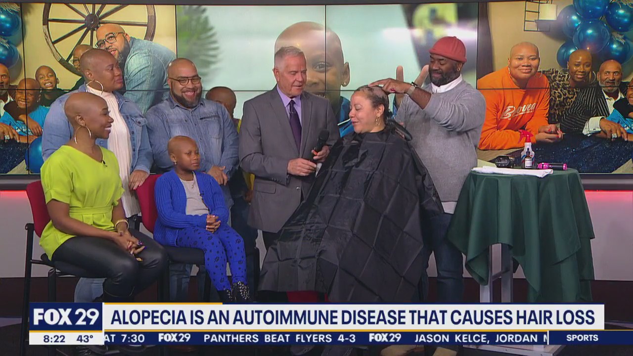 Parents, extended family shave their heads to support young girl with alopecia