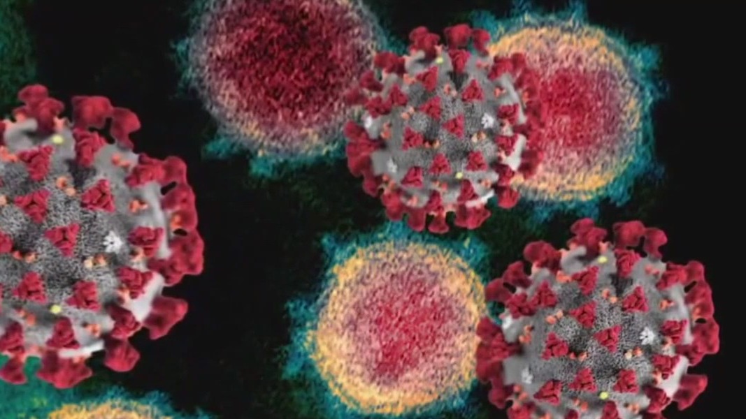 Omicron subvariant XBB.1.5: North Texas doctors closely watching new COVID-19 variant