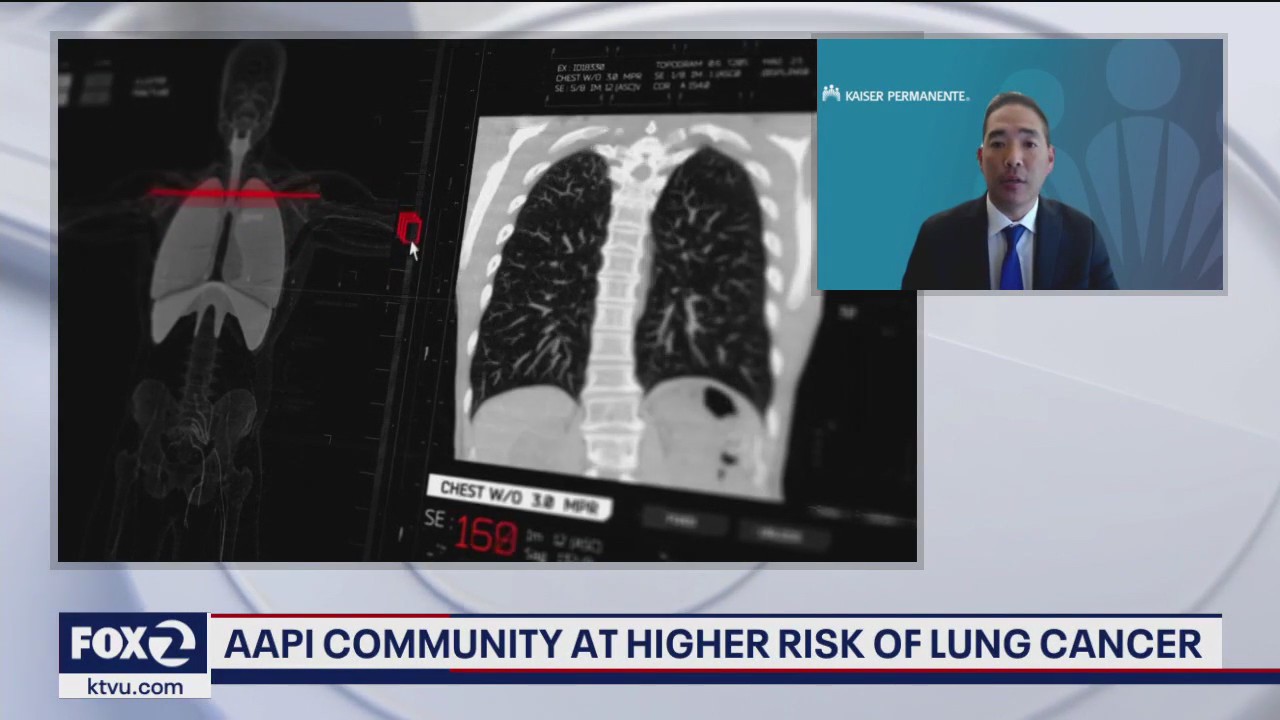 AAPI community at higher risk of lung cancer