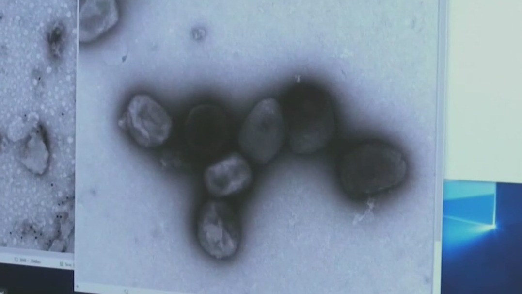 University of Houston preparing for possible Monkeypox cases