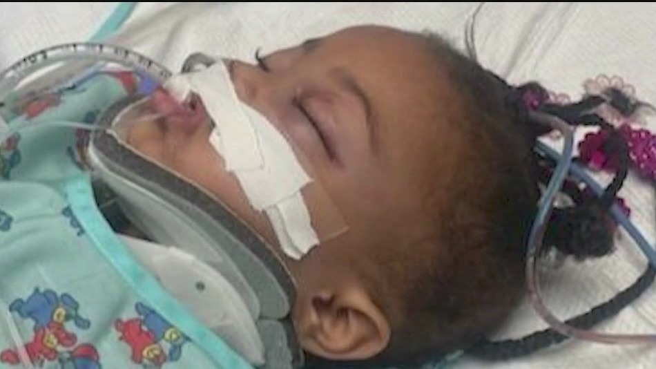 Father of Florida toddler hurt in hit-and-run shares update on daughter