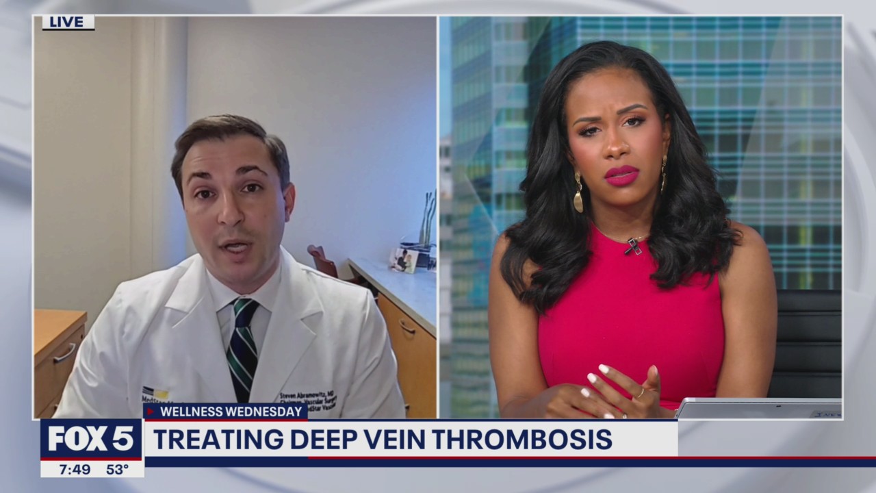 Treatment options for by Deep Vein Thrombosis