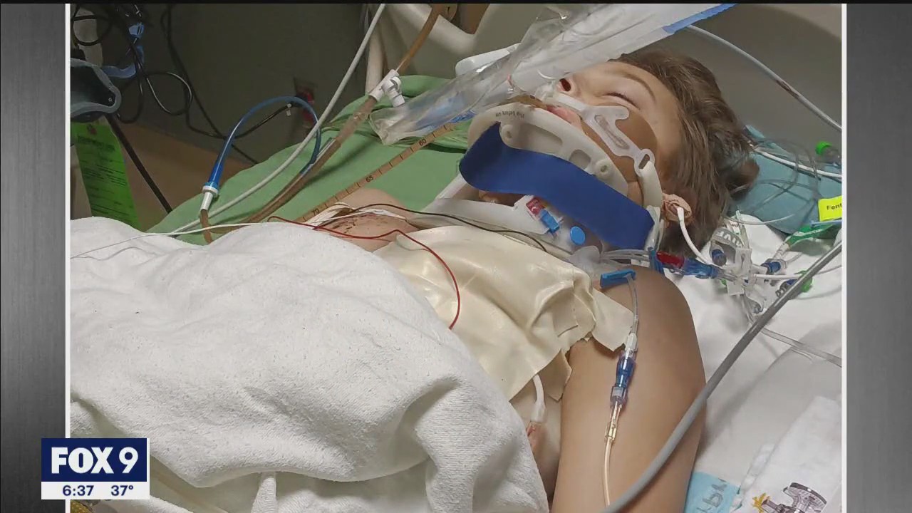 Brothers survive western Wisconsin crash on rollercoaster road, family calls it a miracle