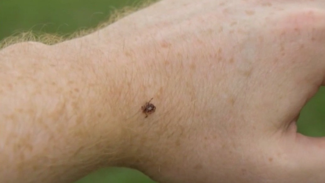 Lyme disease cases on the rise as weather warms up