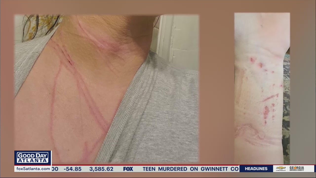 Woman assaulted and robbed while walking dog