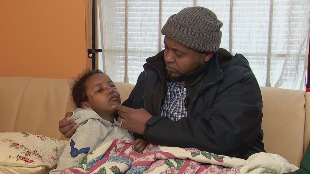 Girl injured after dog attack in St. Paul