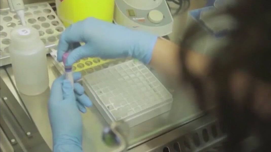 New mpox case reported in Milwaukee