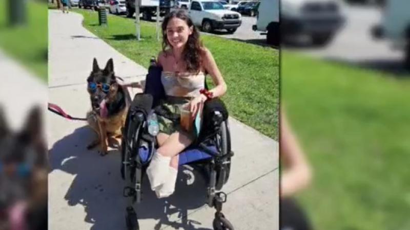 Survivor who lost legs to COVID complications inspires through art